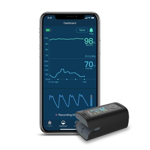 Viatom Oxiosmart Bluetooth HM-PC60FW véroxigénszint mérő